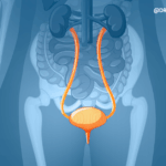 Leia mais sobre o artigo Autonomic Dysreflexia (Disreflexia Autonômica)